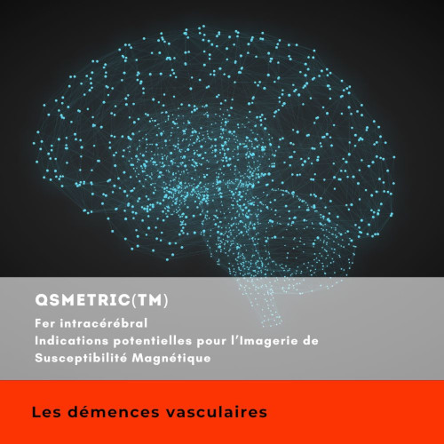 Indications potentielles QSMetric – Les démences vasculaires